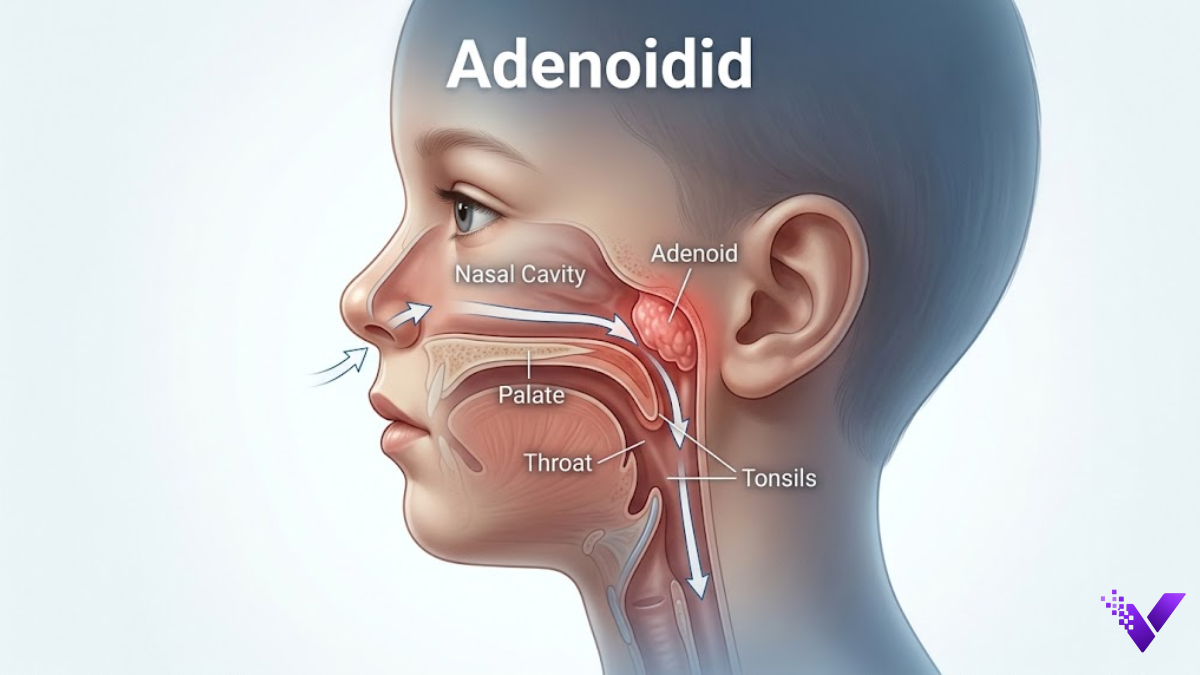 adenoidid